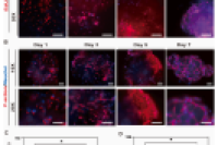 江苏大学徐希明教授&曹霞副教授等人：静电喷雾制备负载外胚间充质干细胞的GelMA微球，用于血管再生