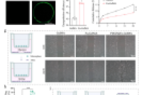 北京大学第三医院王健全教授团队：可注射复合微球/水凝胶膜助力跟腱再生