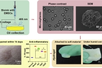 电喷雾水凝胶微球敷料促进血管化，加速伤口愈合