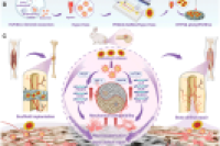 3D打印 + 微流控！钛小梁支架缓释缺氧诱导外泌体，实现双重仿生骨再生