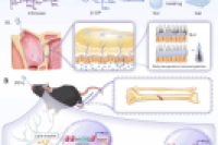 复合微球水凝胶介导PF4鼻脑递送，改善围手术期神经认知障碍
