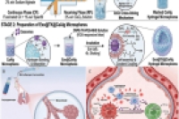 智能雾化ROS响应型水凝胶微球载外泌体，用于急性肺损伤治疗