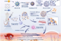 共载姜黄素与干细胞的开放多孔PLGA微球，用于糖尿病创面治疗